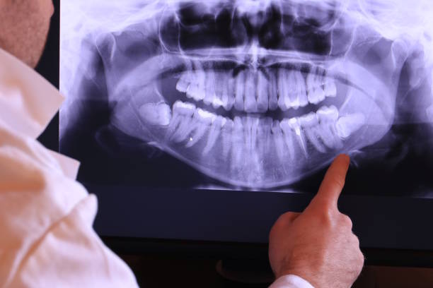 Best Chipped Tooth Repair Near Me  in Port Monmouth, NJ