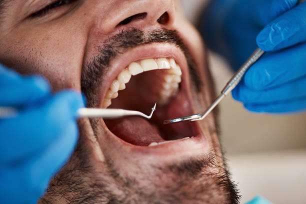 Best Urgent Tooth Repair  in Port Monmouth, NJ